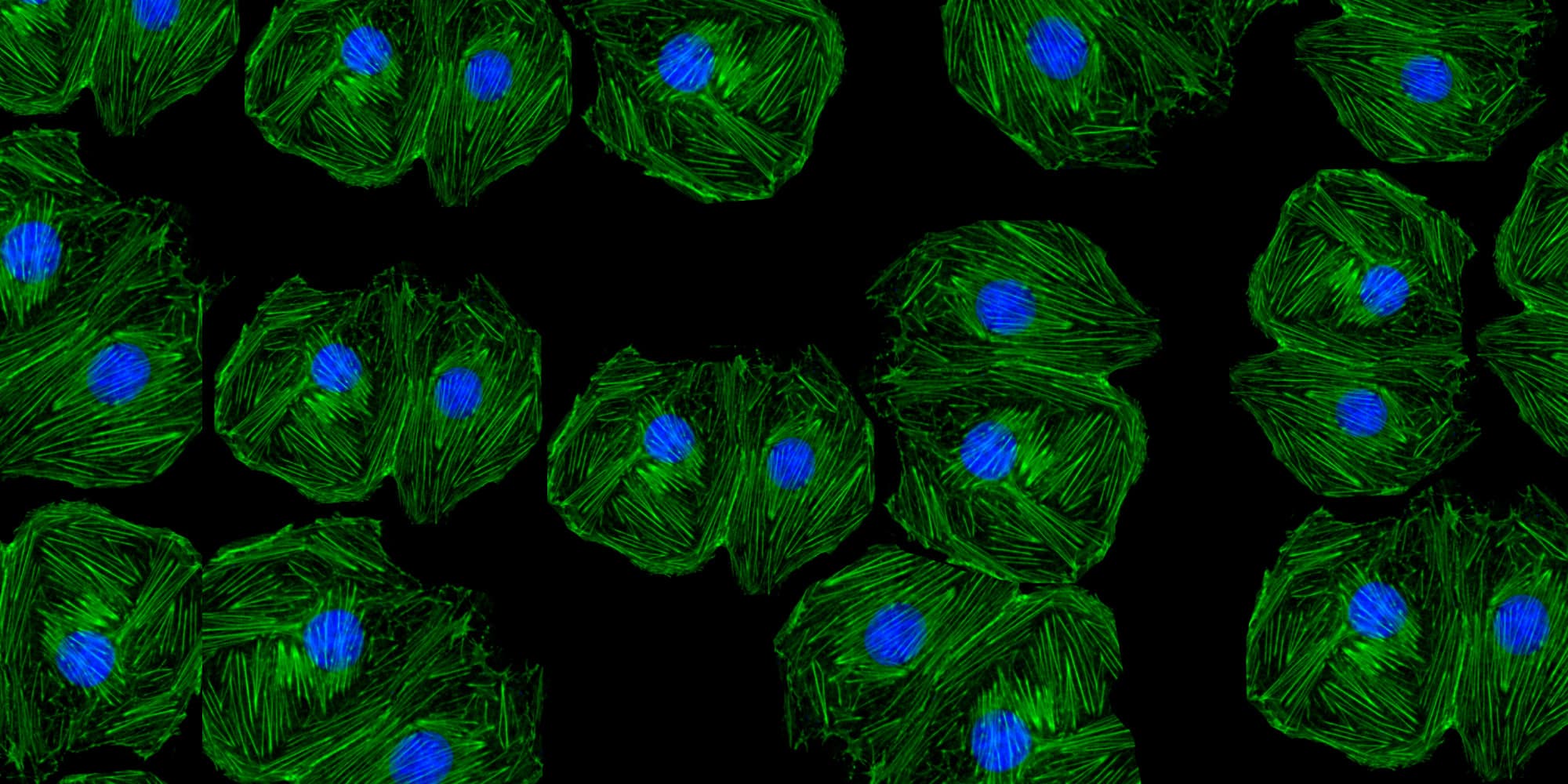 07-Microscope-on-chip_1 Fluorescent microscope view of cells with green fibers and blue nuclei on a black background