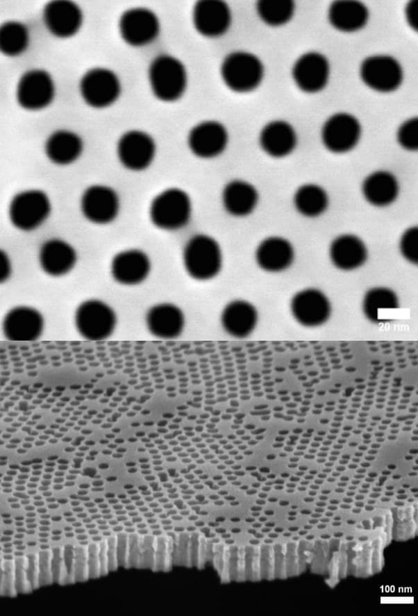 Artificial%20kidney Scanning electron micrographs of a silicon nanopore membrane used for an artificial kidney filter.