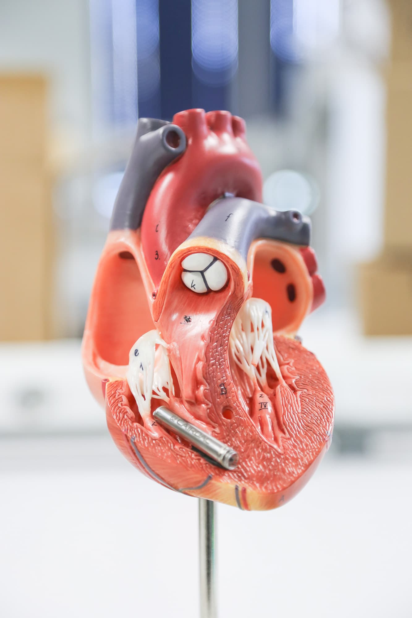 Cairdac-heart An anatomical heart model with a small pacemaker-like device attached