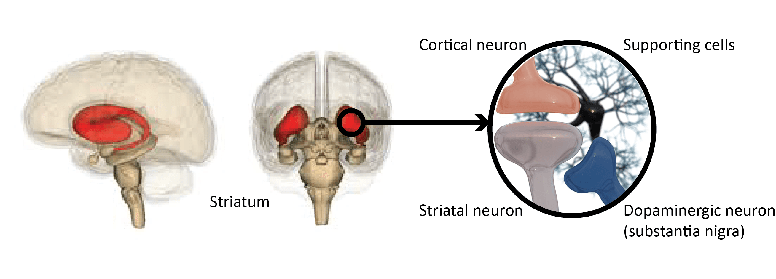 Diagram of striatum and neuron circuit imbalance related to Parkinson’s disease Diagram of the striatum and connected neurons, highlighting a circuit imbalance linked to Parkinson’s disease symptoms.