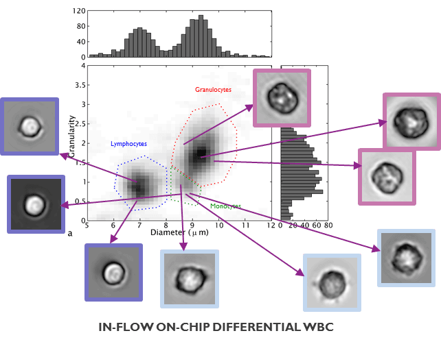 fig6_white_blood_count_0 Diagram of lens-free imaging classifying white blood cells in a chip-based sample flow