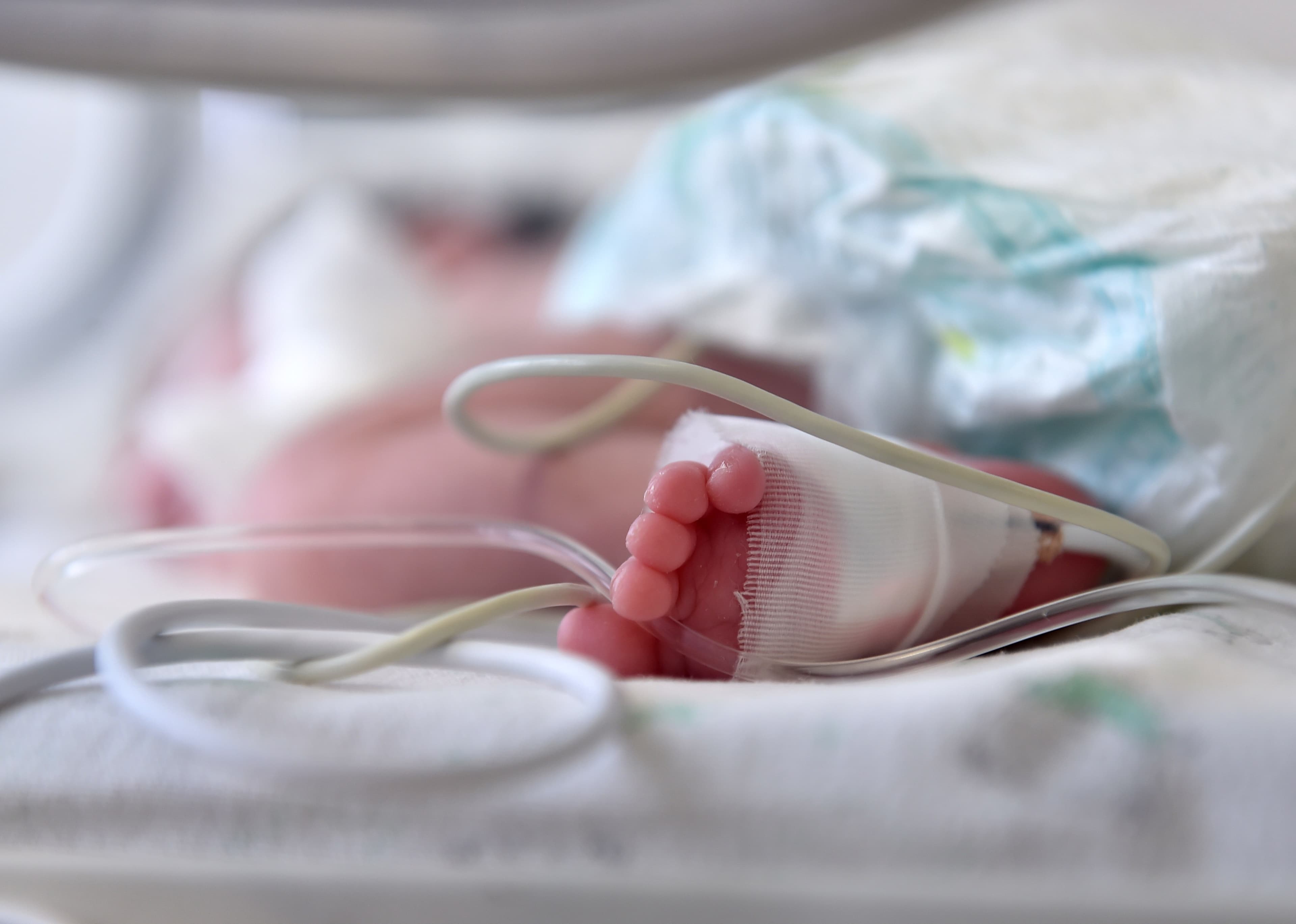 GettyImages-525734880 Pasgeboren baby in een couveuse met bewakingsslangen en een verbonden voet