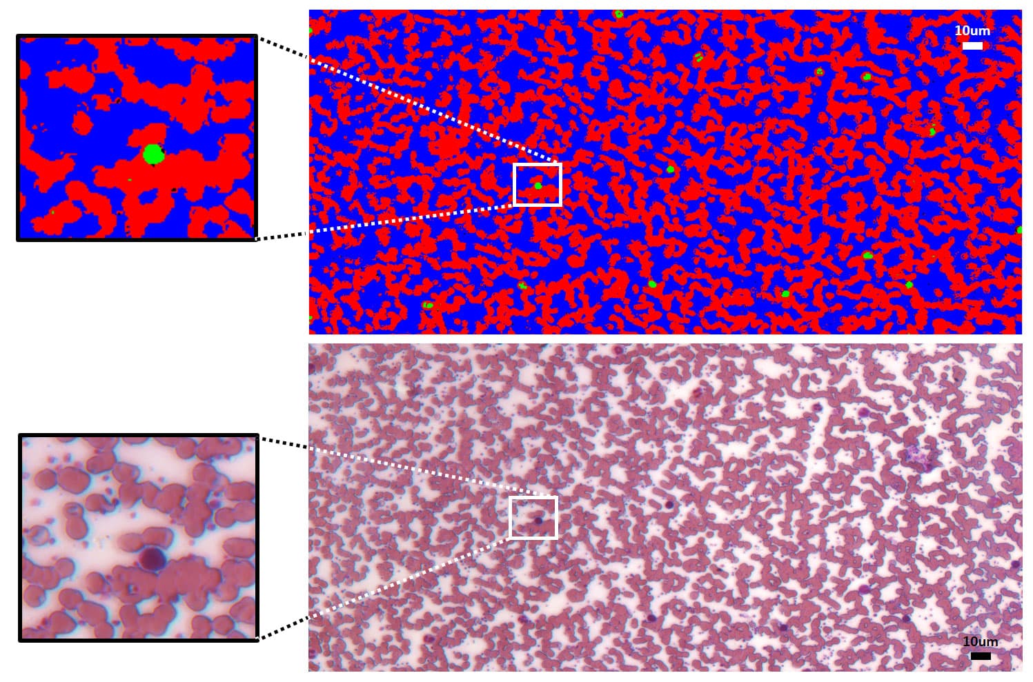 hyperspectral_imaging_microscopy_pathology_1 Hyperspectral blood smear microscopy showing classified and reconstructed views of red and white blood cells.