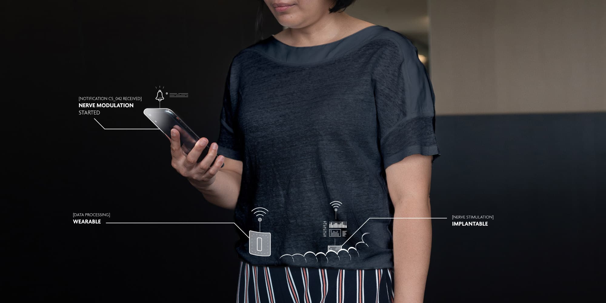 Imec-And-NeuroGyn-AG-Collaborate-On-Advanced-Neurostimulation-Device-For-Pelvic-Nerve-Disorders Woman holding a smartphone beside a diagram of wearable and implantable nerve stimulation devices