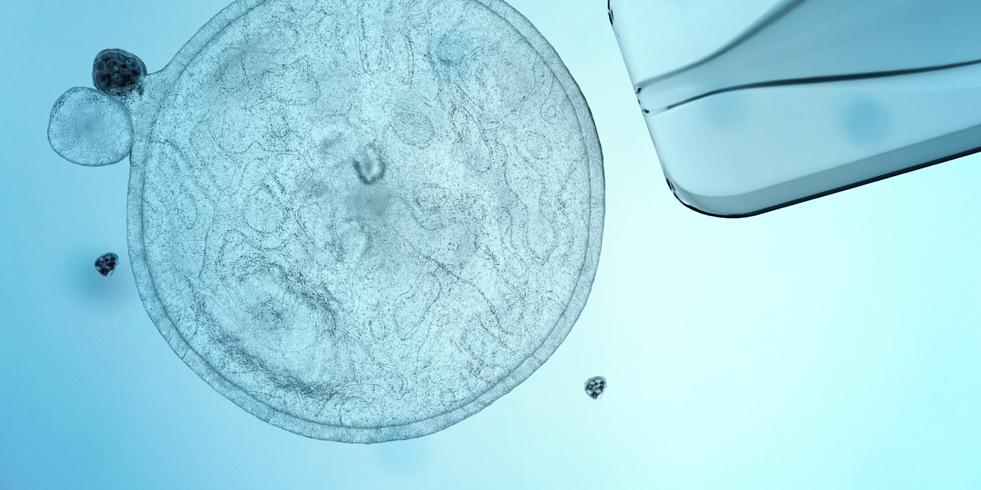 imec_life-sciences_cell-and-gene-therapy_1 Microscopic cell culture beside a transparent lab chip, illustrating bioprocess monitoring.