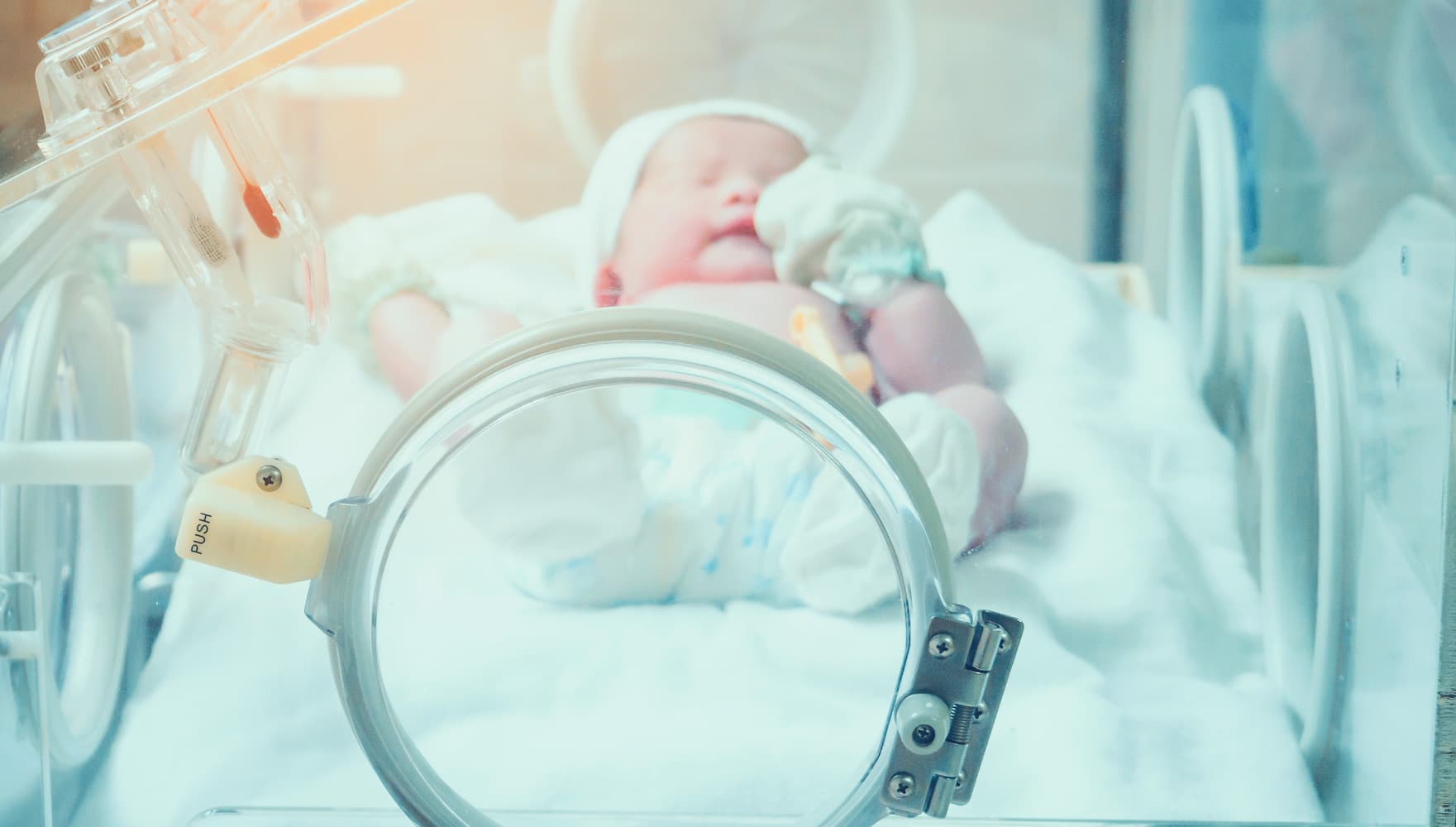 imec-magazine-ai-special-14_vroeggeboortes_1 Te vroeg geboren baby rust in een couveuse met medische slangen en bewakingsapparatuur