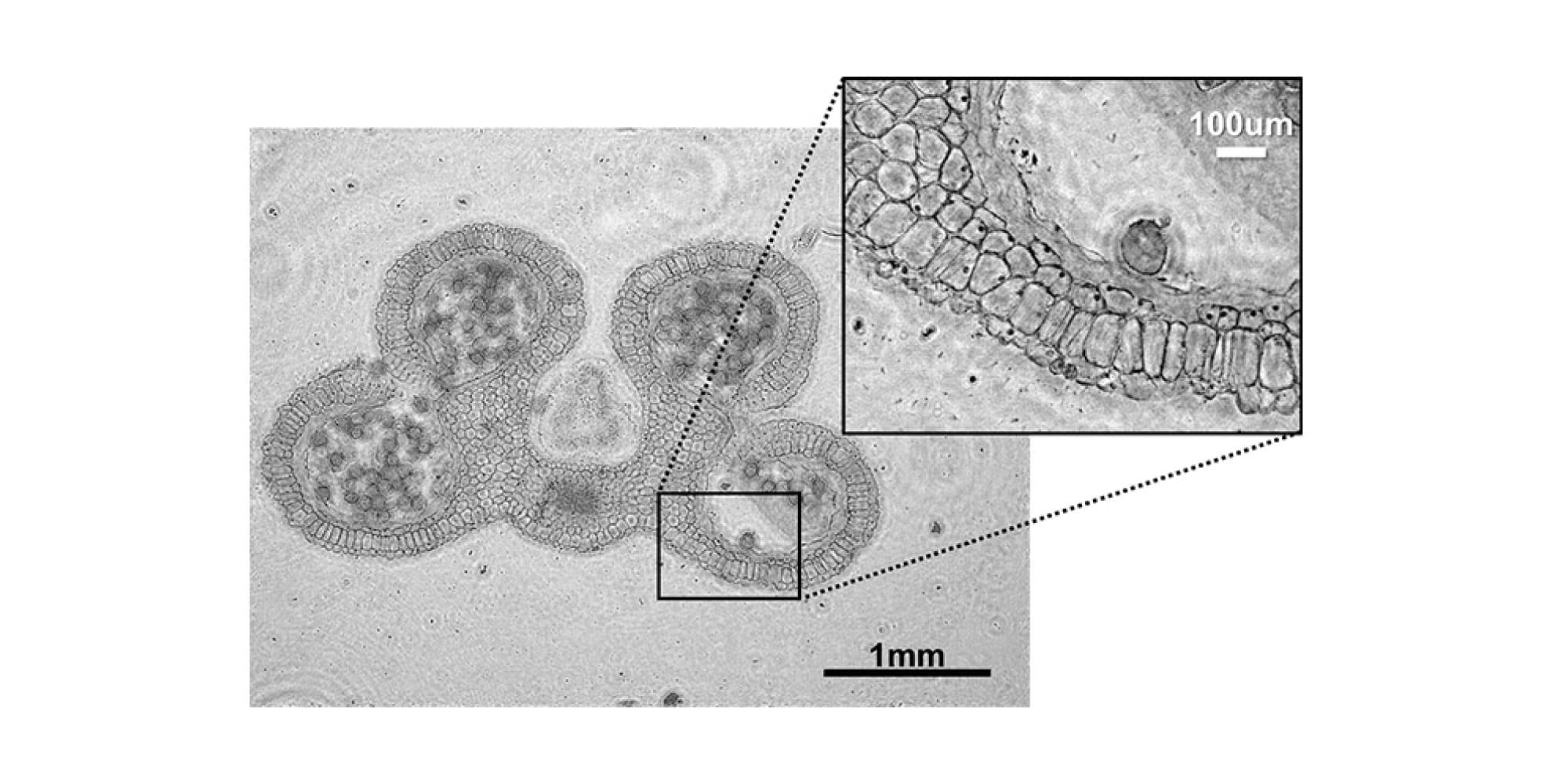 Lens-free%20image Computational microscope image of a lily anther, with a magnified inset showing cell structure.