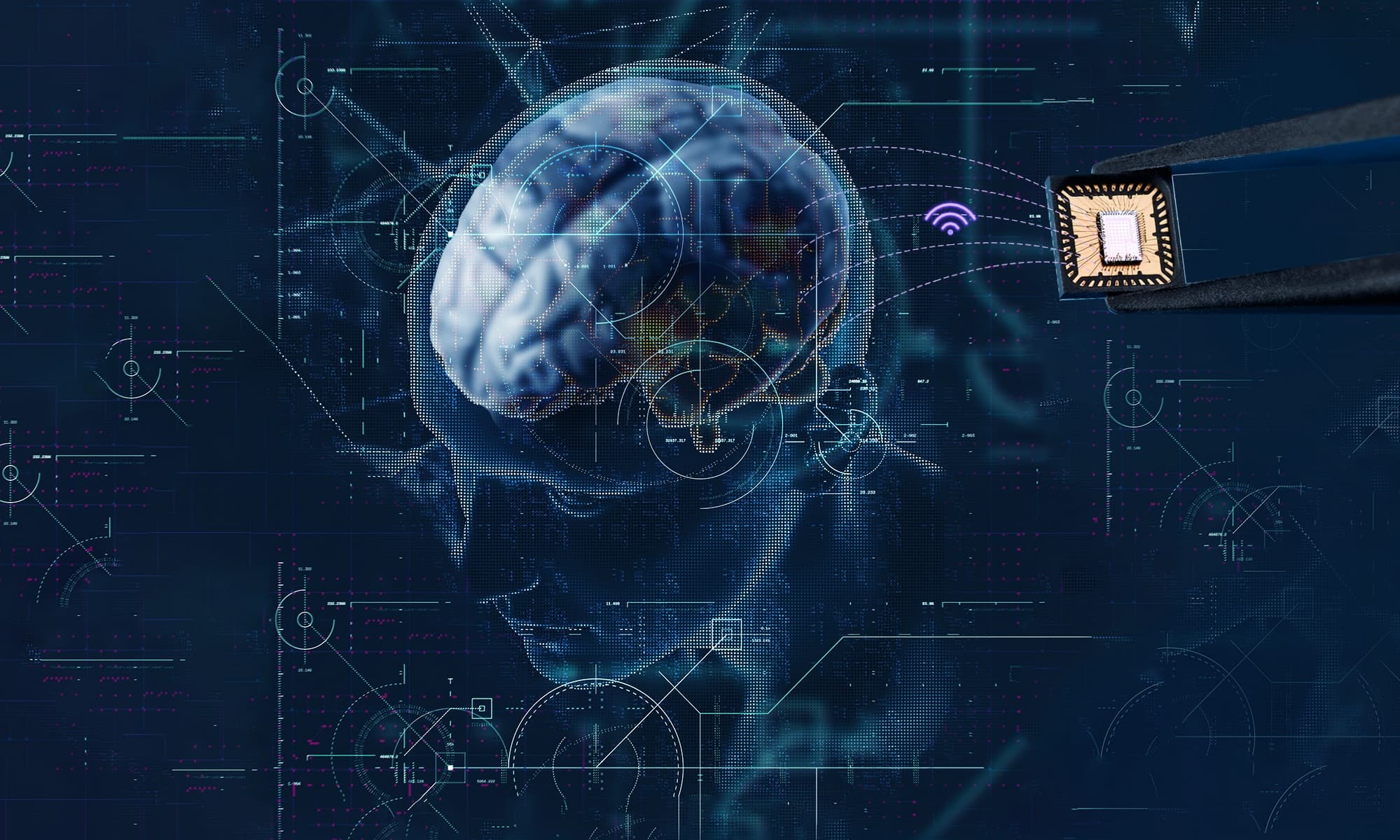 Stylized brain with neural chip and digital circuitry Stylized brain with digital circuitry and a neural chip, suggesting brain-signal telemetry and wireless data transfer