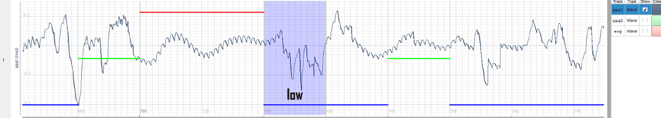 PPG signal graph with activity and signal quality PPG signal graph labeled with activity, motion artefacts and signal quality bars