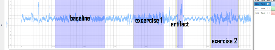 ECG signal chart with highlighted segments ECG signal chart with highlighted baseline, exercise, and artifact segments