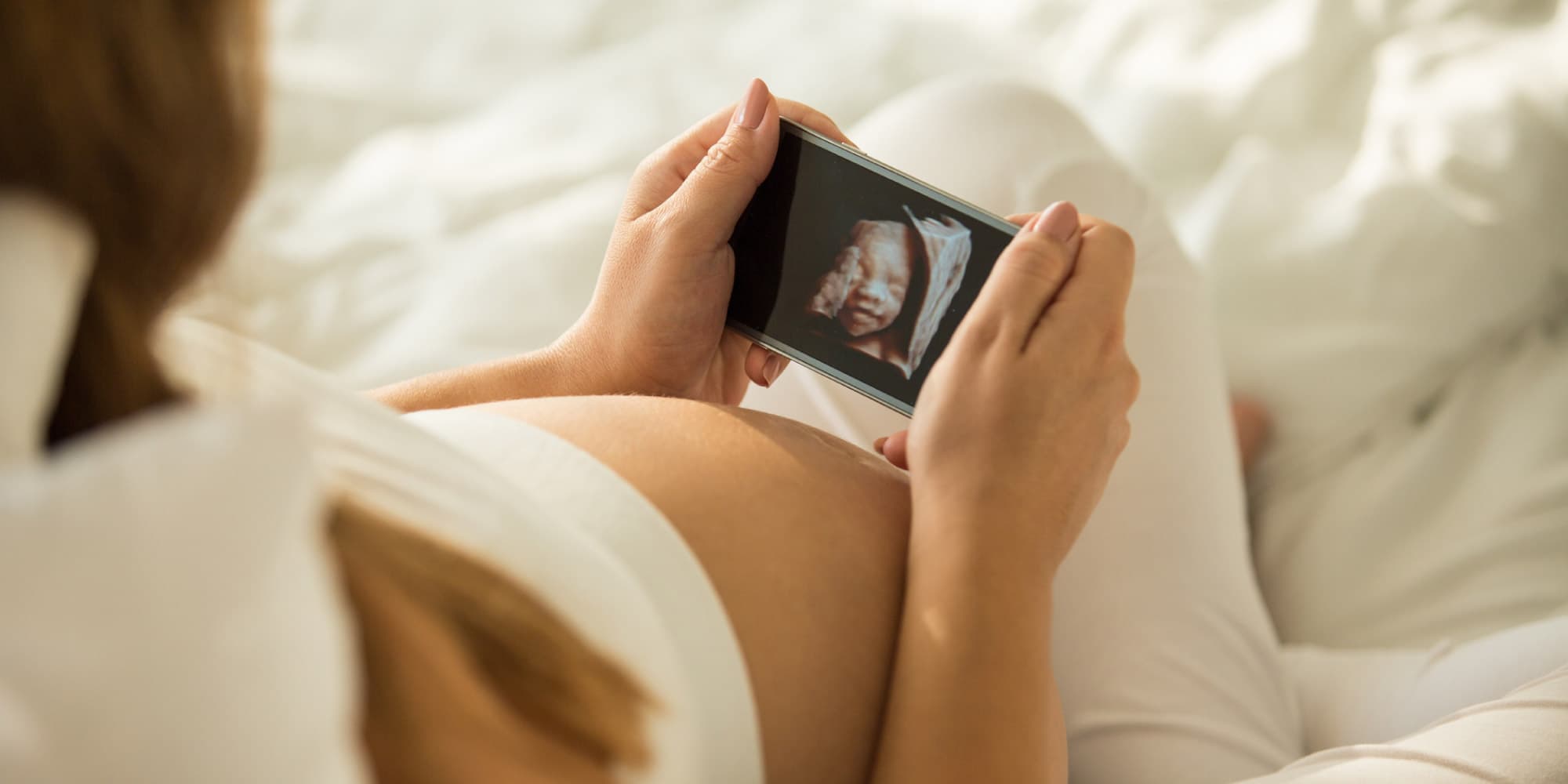 pulsify Zwangere persoon houdt een smartphone vast waarop een 3D-echo van een baby te zien is