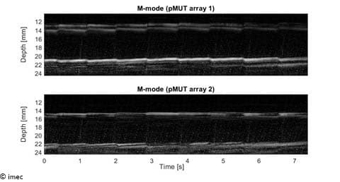 Signal-traces M-modus echografiesignaaltraces die diepte in de tijd tonen in twee arrays