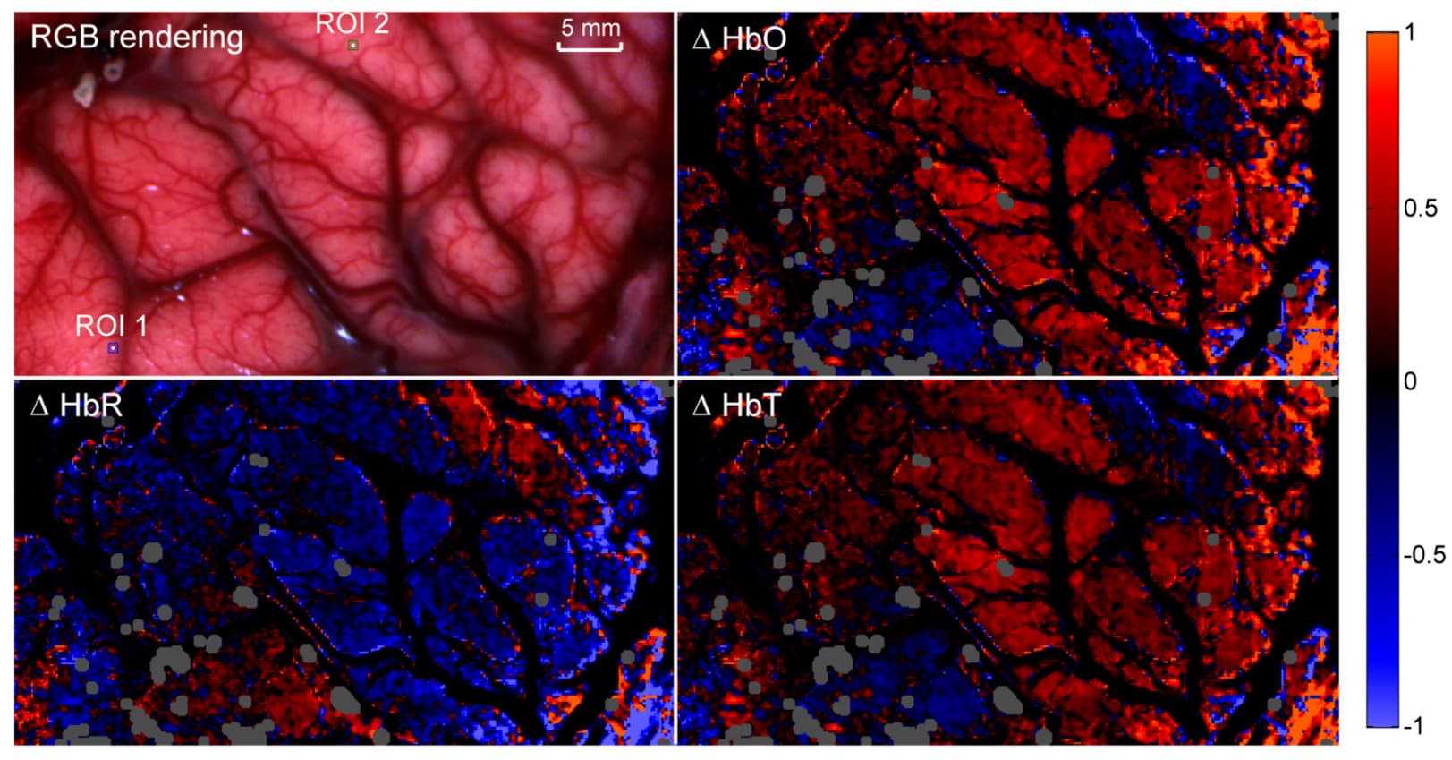 snapshot_hyperspectral_imaging_oxygenation_map_brain_surgery_1 Hyperspectral brain surgery maps showing RGB rendering and oxygenation, hemoglobin, and blood-volume overlays