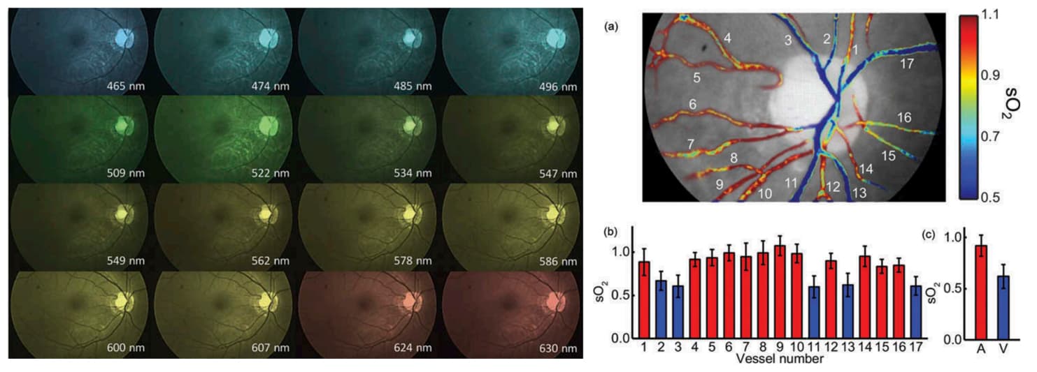 snapshot_hyperspectral_retina_imaging_oxygenation_map_1 Hyperspectral retina images with wavelength bands and an oxygenation map of blood vessels